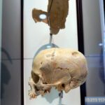 Skull with trepanation